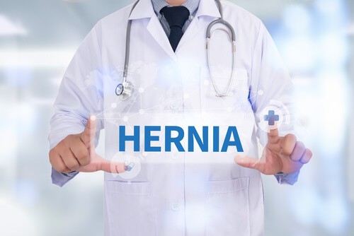 Hiatal Hernia After Gastric Sleeve