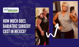 Weight Loss Surgery Cost in Mexico