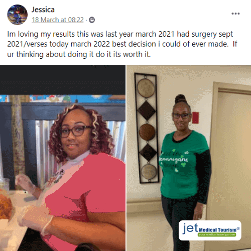 Weight Loss Surgery Success Story