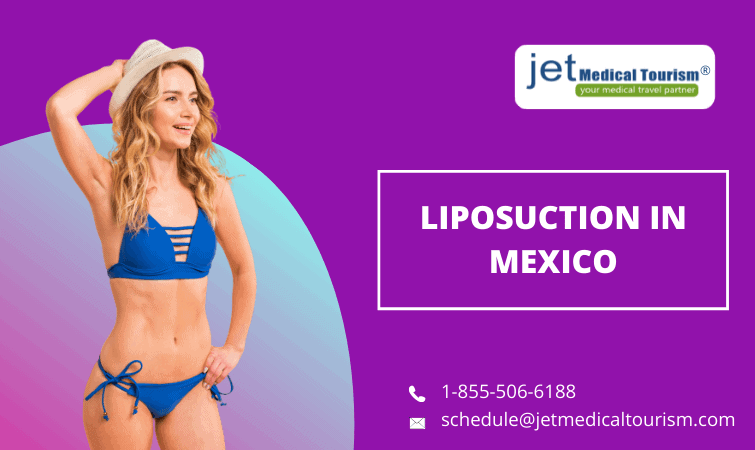 Liposuction in Mexico