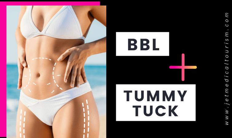 BBL and Tummy Tuck