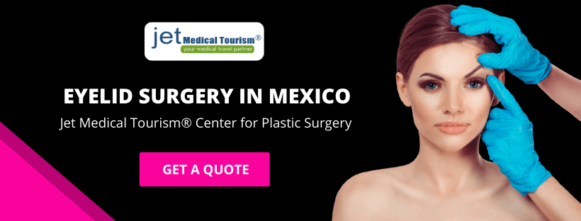 Eyelid Surgery in Mexico