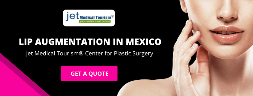 Lip Augmentation in Mexico