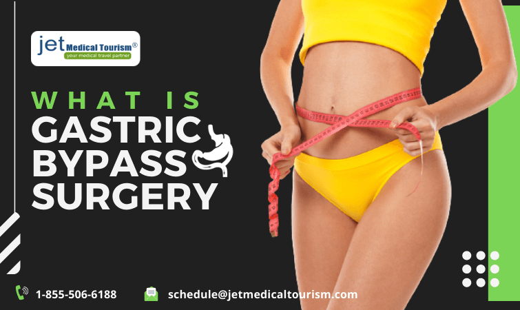 What is Gastric Bypass Surgery