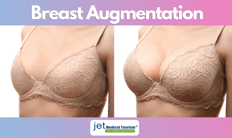 Breast Augmentation Near Me