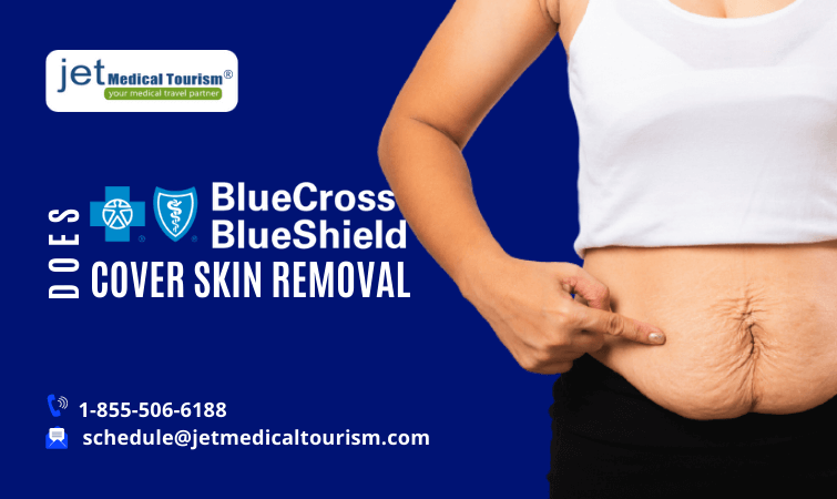 Does Blue Cross Blue Shield Cover Skin Removal?