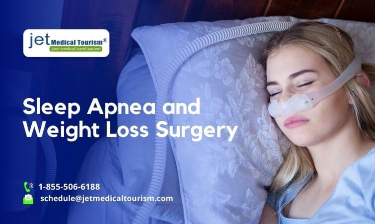 sleep apnea and weight loss surgery